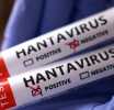 No sign of larger hantavirus outbreak, says UN health agency