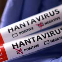 No sign of larger hantavirus outbreak, says UN health agency
